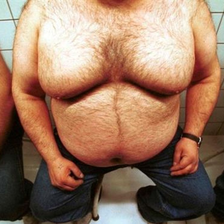 Obesidade | Uma crise de saúde global maior que a fome